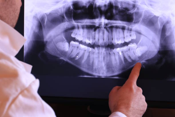 Best Emergency Tooth Extraction in Lan, MI
